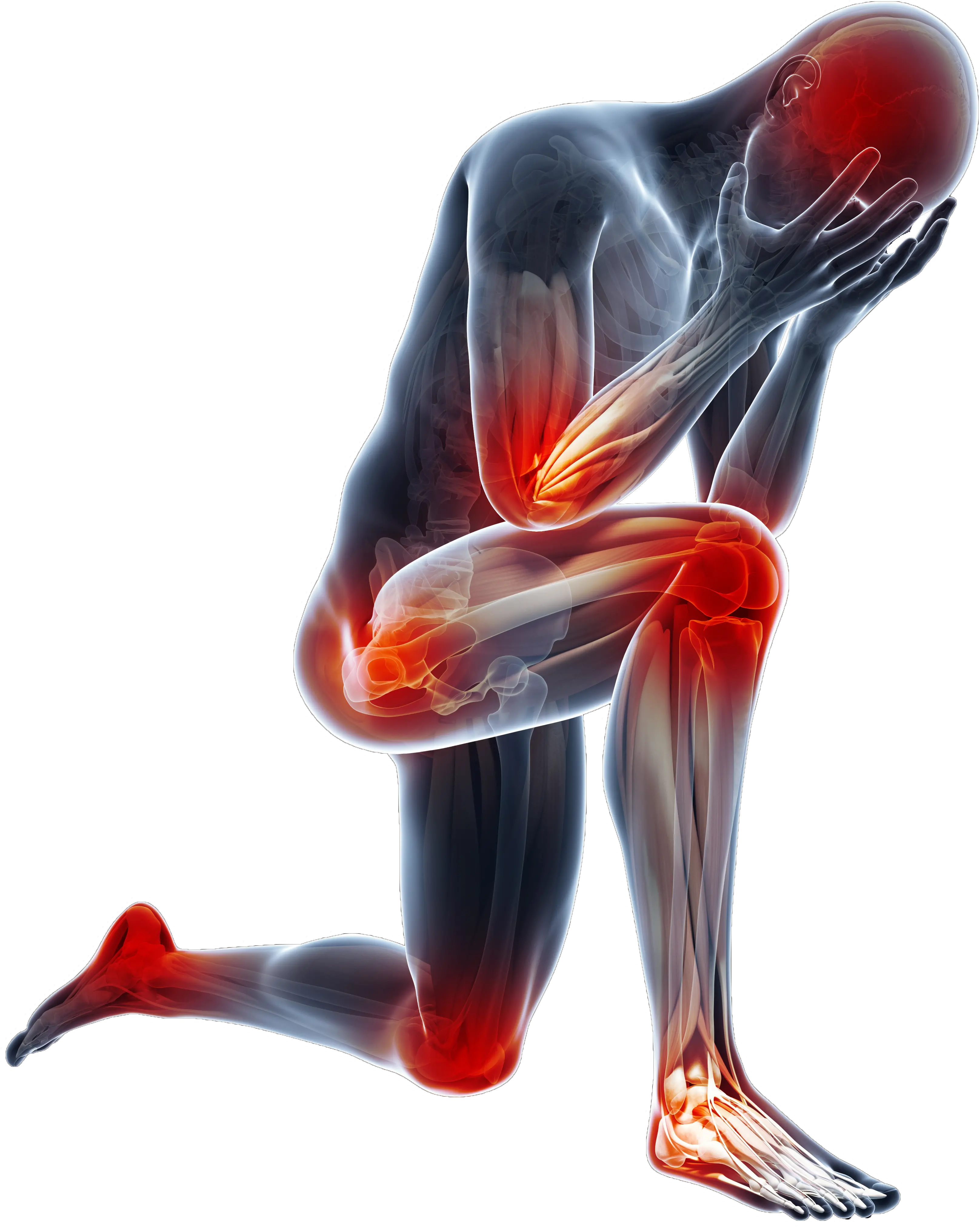 Body Pain 2 Copy Body Sprains And Strains