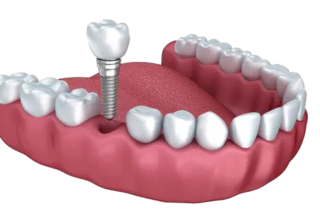teeth png